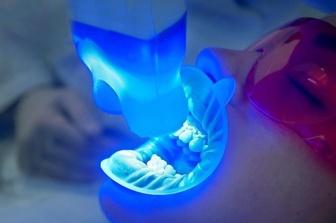 Estética Dental